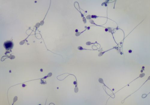 To Boost Sperm Count, Get Off the Couch