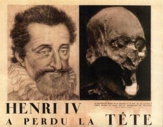 Henri IV's Long-Lost Skull: Found in an Attic?
