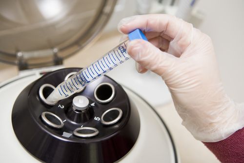 Louisiana Man Sues Clinic, Says Ex Stole Sperm