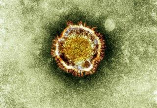 Deadly SARS-like Virus Spreads to Italy