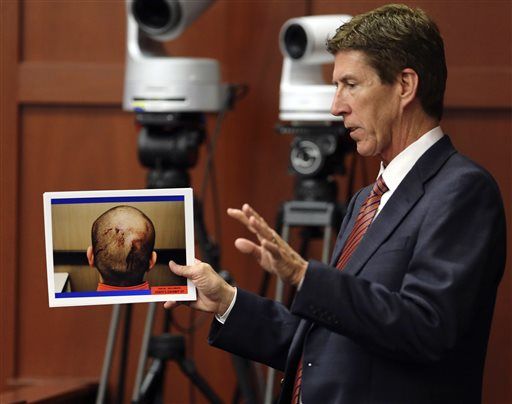 Doc: Zimmerman's Wounds 'Insignificant'
