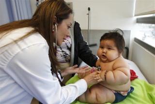 Colombia's Fattest Baby 'Rescued'