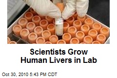 Scientists Grow Human Livers in Lab