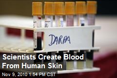 Medical Breakthrough: Own Blood Made From Skin
