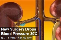 Surgery Lowers Blood Pressure Up to 30%