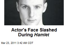 Actor's Face Slashed During Hamlet