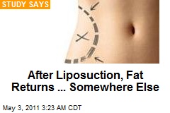 Liposuction Fat Reappears On Arms, Belly