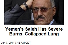 Yemen's Ali Abdullah Saleh Has Collapsed Lung, Severe Burns