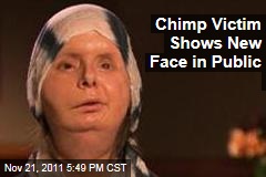 Chimpanzee Attack Victim Charla Nash Shows Surgically Transplanted Face in Public