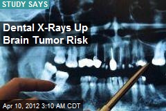 Dental X-Rays Linked to Brain Tumor Risk