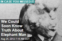 We Could Soon Know Truth About Elephant Man