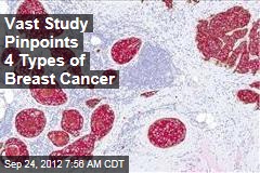 Vast Study Pinpoints 4 Types of Breast Cancer