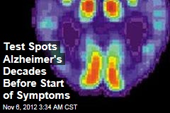 Test Spots Alzheimer&#39;s Decades Before Symptoms Appear