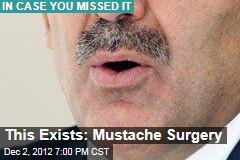 This Exists: Mustache Surgery