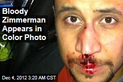 Bloody Zimmerman Appears in Color Photo