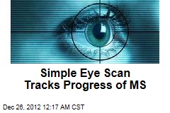 Simple Eye Scan Tracks Progress of MS
