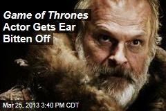 Game of Thrones Actor Gets Ear Bitten Off