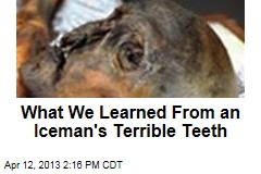 What We Learned From an Iceman&#39;s Terrible Teeth