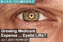 Growing Medicare Expense ... Eyelid Lifts?