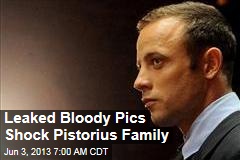 Leak of Bloody Pics Shocks Pistorius Family