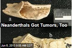 Neanderthals Got Tumors, Too