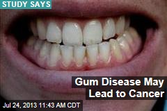 Gum Disease May Lead to Cancer