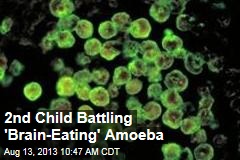 2nd Child Battling &#39;Brain-Eating&#39; Amoeba