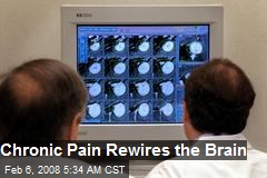 Chronic Pain Rewires the Brain