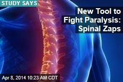 New Tool to Fight Paralysis: Spinal Zaps