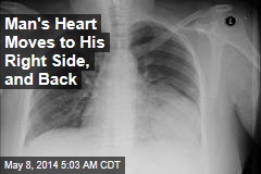 Man&#39;s Heart Moves to His Right Side, and Back