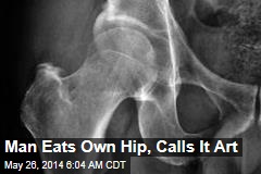 Student Eats Own Hip for Art Project