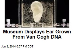 Museum Displays Ear Grown From Van Gogh DNA