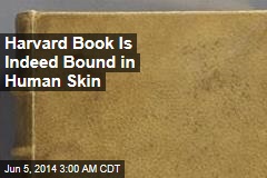 Harvard: One of Our Books Is Bound in Human Skin