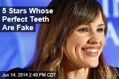 5 Stars Whose Perfect Teeth Are Fake
