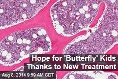 Hope for &#39;Butterfly&#39; Kids Thanks to New Treatment