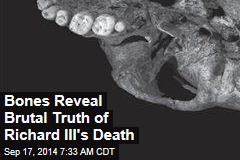 Bones Reveal Brutal Truth of Richard III&#39;s Death