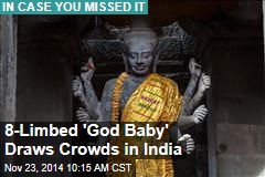 8-Limbed &#39;God Baby&#39; Draws Crowds in India