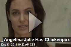 Angelina Jolie Has Chickenpox