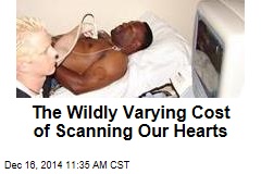 The Wildly Varying Cost of Scanning Our Hearts
