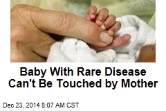 Baby With Rare Disease Can&#39;t Be Touched by Mother