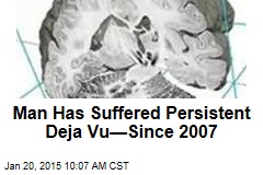 Man Has Suffered Persistent Deja Vu&mdash;Since 2007