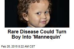 Rare Disease Could Turn Boy Into &#39;Mannequin&#39;