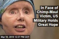 In Face of Chimp-Maul Victim, US Military Holds Great Hope