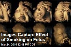 Study Shows Effect of Smoking on Fetus