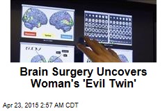 Brain Surgery Uncovers Woman&#39;s &#39;Evil Twin&#39;