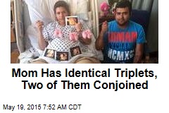 Mom Has Identical Triplets, Two of Them Conjoined