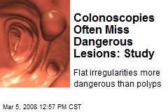 Colonoscopies Often Miss Dangerous Lesions: Study