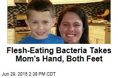 Flesh-Eating Bacteria Takes Mom&#39;s Hand, Both Feet