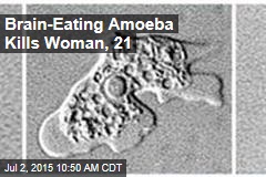 Brain-Eating Amoeba Kills Woman, 21
