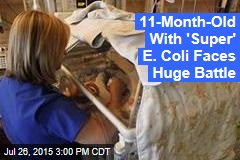 Baby Diagnosed With &#39;Super&#39; E. Coli Strain